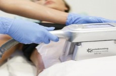 vente privée 3 séances de cryolipolyse - Zone au choix - Procryo - Puteaux