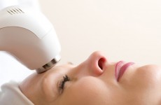 vente privée 1 séance de microneedling - Red Nails & Beauty