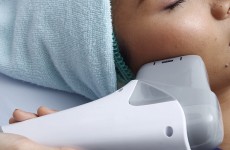 vente privée Séance de HIFU - 1 zone - Procryo - Puteaux