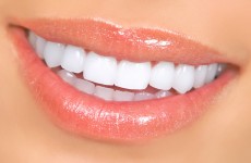 vente privée Blanchiment dentaire - Eyes Concept