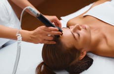vente privée 3 séances de microneedling - Red Nails & Beauty
