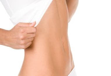 vente privée Cryolipolyse & techniques anti-âge à La Défense