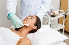 vente privée Soin microneedling avec SThétic Studio