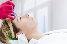 vente privée Séance de microneedling avec Nissa Beauty