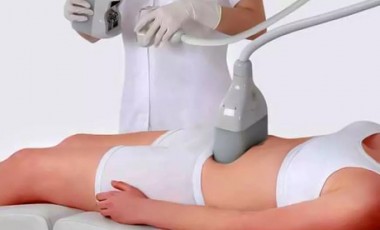 vente privée 1 séance de cryolipolyse sur 1 zone au choix